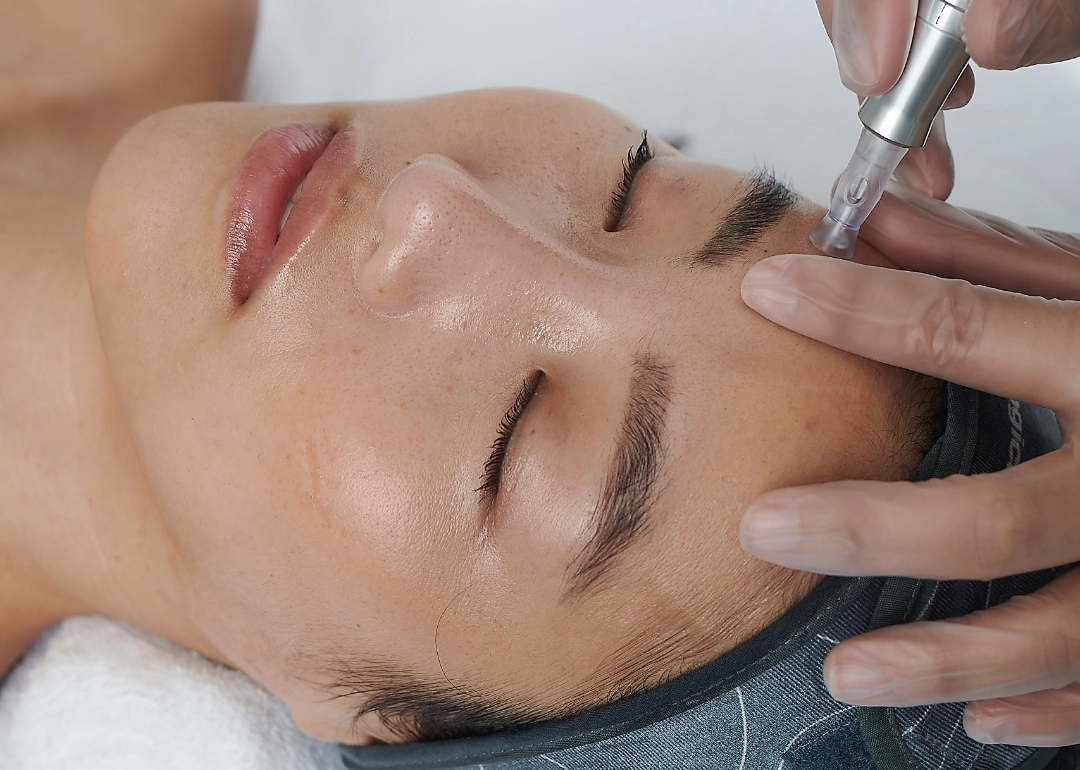 Sunfit_Beauty_Care_Demalogica_Microneedling_Facial
